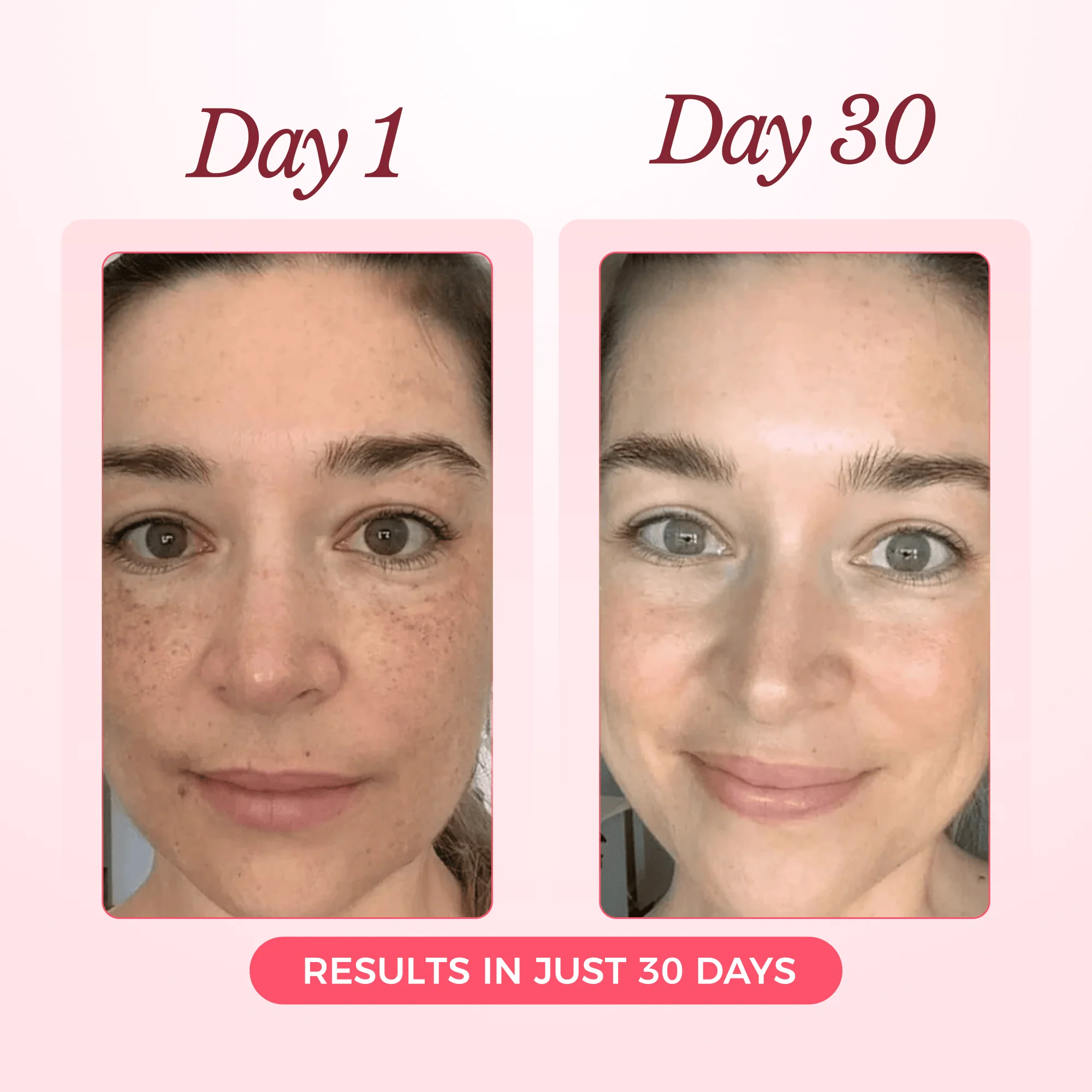 Bio - Collagen Mask™