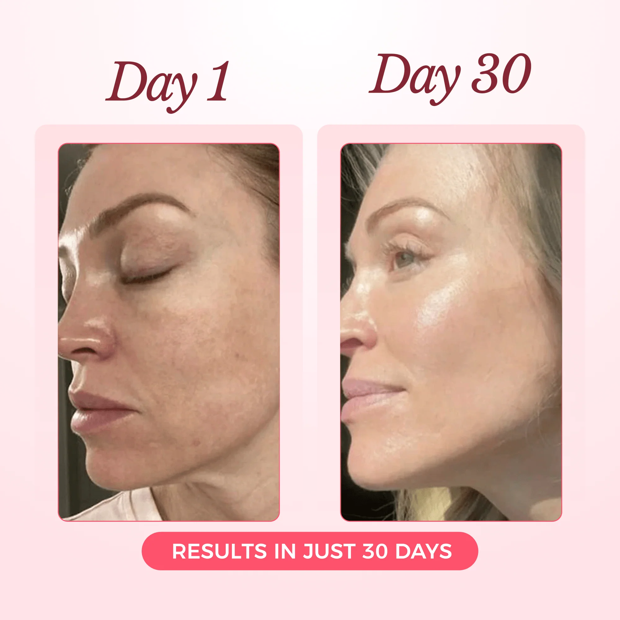 Bio - Collagen Mask™